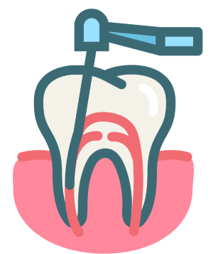 Root Canal Treatment